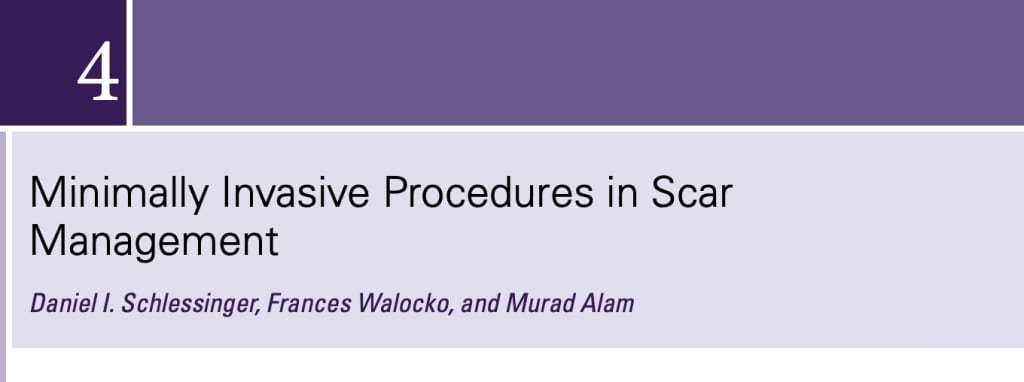 Minimally Invasive Procedures in Scar Management