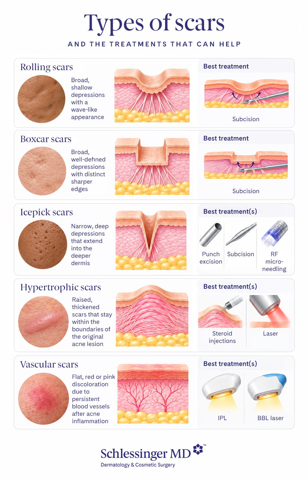 Types of scars graphic